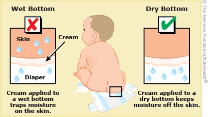 Best Way to Heal Baby Diaper Rash